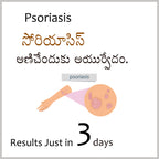 Psoriasis Care Pack